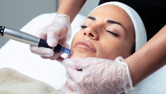 Chuyên viên chăm sóc da thực hiện liệu trình kích thích collagen (microneedling)